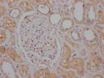 Raptor Antibody in Immunohistochemistry (Paraffin) (IHC (P))