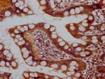 Raptor Antibody in Immunohistochemistry (Paraffin) (IHC (P))