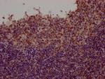 Fyn Antibody in Immunohistochemistry (Paraffin) (IHC (P))