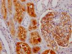 CD249 Antibody in Immunohistochemistry (Paraffin) (IHC (P))