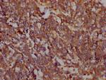 FAK Antibody in Immunohistochemistry (Paraffin) (IHC (P))