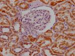 MAOA Antibody in Immunohistochemistry (Paraffin) (IHC (P))