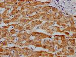 MAOA Antibody in Immunohistochemistry (Paraffin) (IHC (P))