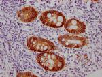 A33 Antibody in Immunohistochemistry (Paraffin) (IHC (P))