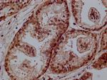 AMPK gamma-1 Antibody in Immunohistochemistry (Paraffin) (IHC (P))