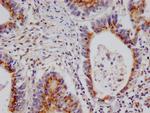 PSME1 Antibody in Immunohistochemistry (Paraffin) (IHC (P))