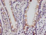 PSME1 Antibody in Immunohistochemistry (Paraffin) (IHC (P))