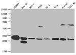 PSME1 Antibody in Western Blot (WB)