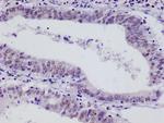 HIF1AN Antibody in Immunohistochemistry (Paraffin) (IHC (P))