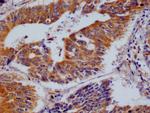 BAP31 Antibody in Immunohistochemistry (Paraffin) (IHC (P))