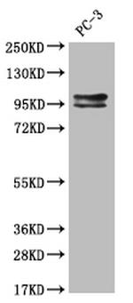 KAP3 Antibody in Western Blot (WB)