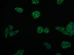 Arginase 2 Antibody in Immunocytochemistry (ICC/IF)