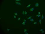 ACAA2 Antibody in Immunocytochemistry (ICC/IF)