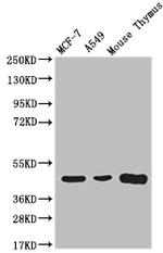 ACAA2 Antibody in Western Blot (WB)