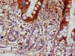 SCIN Antibody in Immunohistochemistry (Paraffin) (IHC (P))