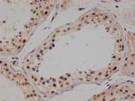 PIN4 Antibody in Immunohistochemistry (Paraffin) (IHC (P))