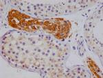 NSDHL Antibody in Immunohistochemistry (Paraffin) (IHC (P))