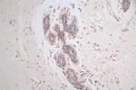 GAA Antibody in Immunohistochemistry (Paraffin) (IHC (P))