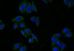 GLUT2 Antibody in Immunocytochemistry (ICC/IF)