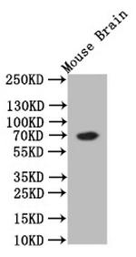 ChAT Antibody in Western Blot (WB)