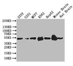 EGR2 Antibody in Western Blot (WB)