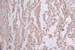 LGR6 Antibody in Immunohistochemistry (Paraffin) (IHC (P))