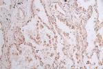 GPI Antibody in Immunohistochemistry (Paraffin) (IHC (P))