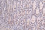 PRKAR2A Antibody in Immunohistochemistry (Paraffin) (IHC (P))