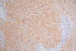 MICA Antibody in Immunohistochemistry (Paraffin) (IHC (P))