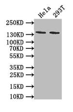 PKN2 Antibody in Western Blot (WB)