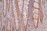 BAX Antibody in Immunohistochemistry (Paraffin) (IHC (P))