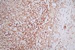 PAX6 Antibody in Immunohistochemistry (Paraffin) (IHC (P))