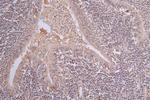 PI3K p85 alpha Antibody in Immunohistochemistry (Paraffin) (IHC (P))