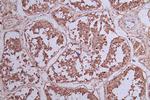 BCL6 Antibody in Immunohistochemistry (Paraffin) (IHC (P))