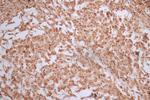 Ferritin Heavy Chain Antibody in Immunohistochemistry (Paraffin) (IHC (P))