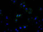 ATP7B Antibody in Immunocytochemistry (ICC/IF)