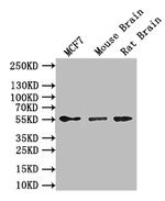 GFAP Antibody in Western Blot (WB)