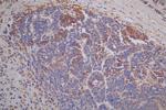 TK1 Antibody in Immunohistochemistry (Paraffin) (IHC (P))