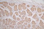 SNRPD1 Antibody in Immunohistochemistry (Paraffin) (IHC (P))