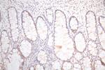 UBE2C Antibody in Immunohistochemistry (Paraffin) (IHC (P))