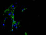 Gelsolin Antibody in Immunocytochemistry (ICC/IF)