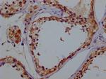 GSTM3 Antibody in Immunohistochemistry (Paraffin) (IHC (P))