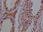 GSTM3 Antibody in Immunohistochemistry (Paraffin) (IHC (P))