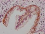 Claudin 18 Antibody in Immunohistochemistry (Paraffin) (IHC (P))