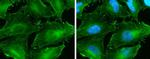 beta Catenin Antibody in Immunocytochemistry (ICC/IF)