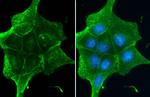 beta Catenin Antibody in Immunocytochemistry (ICC/IF)