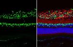 PAX6 Antibody in Immunohistochemistry (Paraffin) (IHC (P))