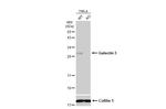 Galectin 3 Antibody in Western Blot (WB)