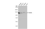 ACE2 Antibody in Western Blot (WB)