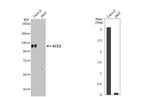 ACE2 Antibody in Western Blot (WB)